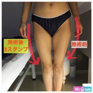 U10BeforeAfter.jpg