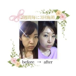 beautyexpo2-300x300.jpeg