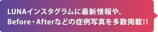 LUNAインスタグラムに最新情報や、Before・Afterなどの症例写真を多数掲載‼